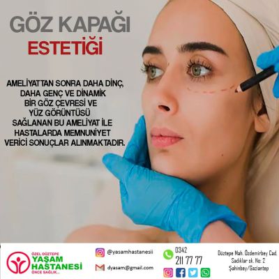 Göz Kapağı